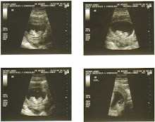 10 Week Ultrasound 12-22-08