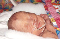 [2004.09.23HollandCannula.jpg]