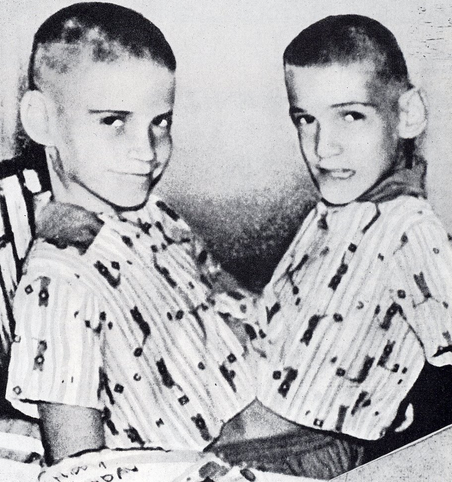 Bilim Adı Altında Acımasız İşkencelere Maruz Kalmış Yapışık İkizlerin Yürek Burk