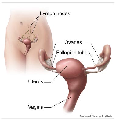 [49-ovarian+cancer+prognosis.jpg]