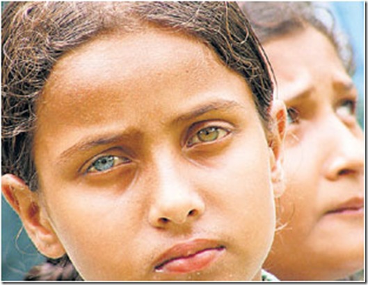 Eye Colors Child With Heterochromia eye-colors-child-with-heterochromia