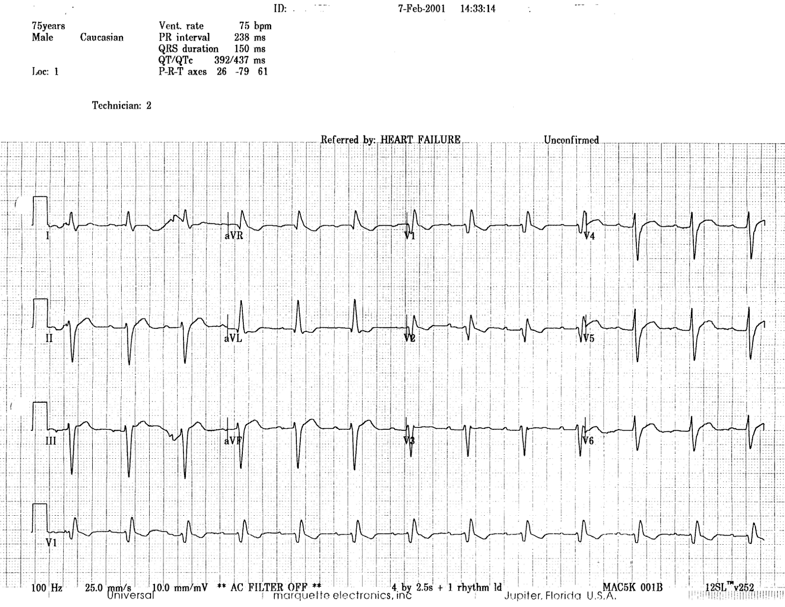 Case of the Day Peas in a Pod