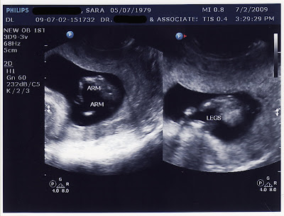 Schweigert Ramblings: 12 Week Ultrasound