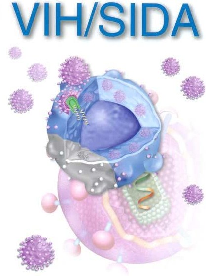 VIH/SIDA
