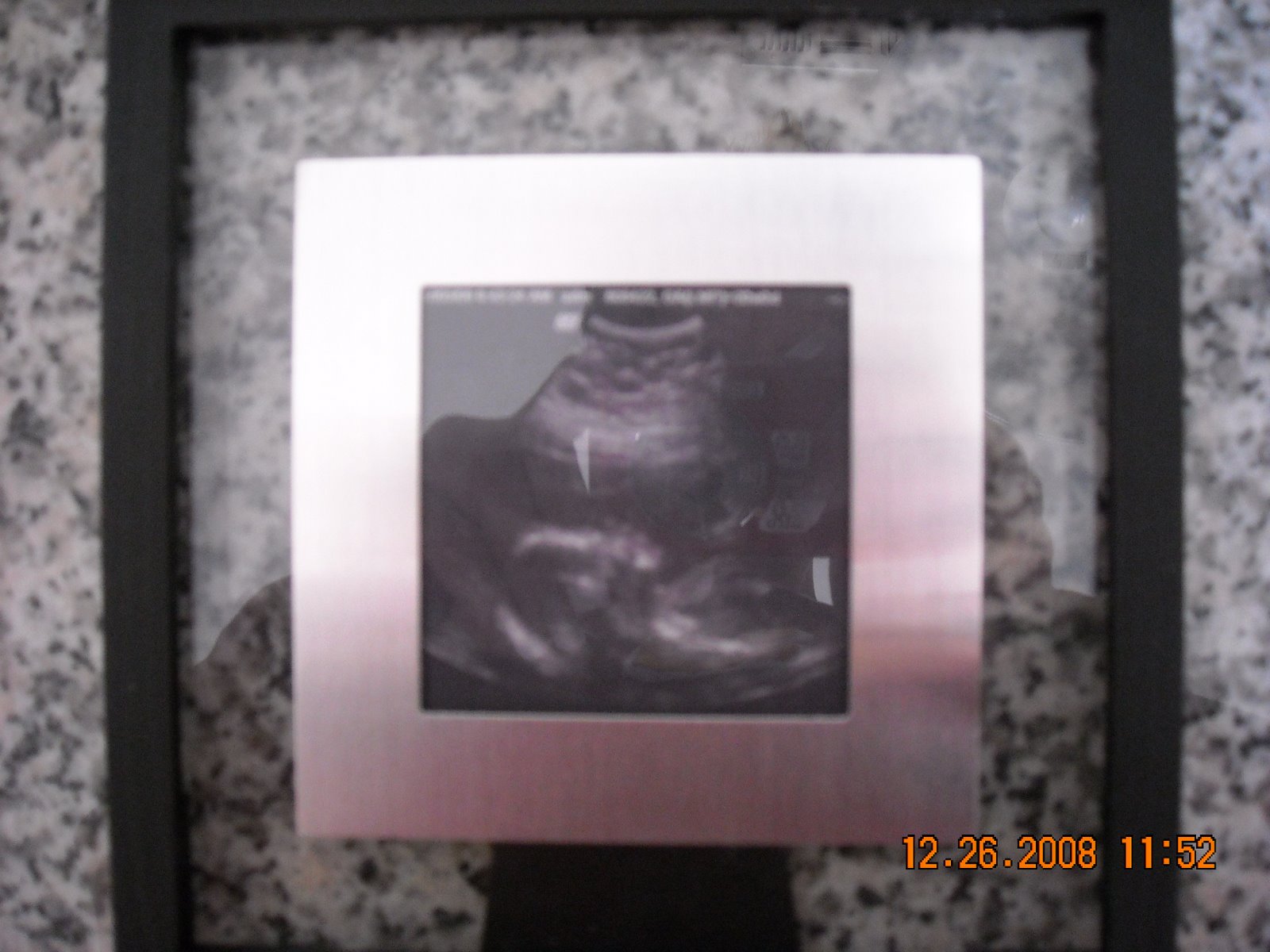 [Christmas+Day+2008.+003.jpg]