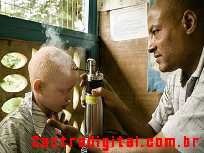 [negros-albinos-africa-21.jpg]