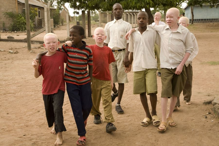[morte-albinos-tanzania.jpg]