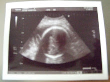 32 Week Scan