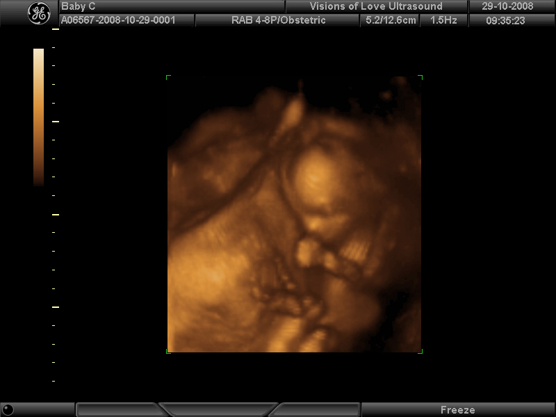 [Baby+picture4.jpg]