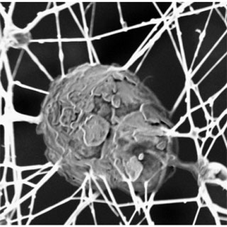 [nanotubecartilage.jpg]