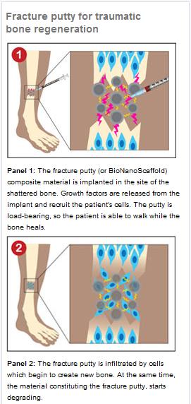 [fractureputty1.jpg]