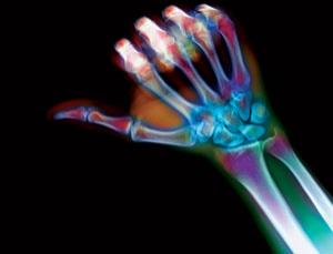 [boneprinting.jpg]