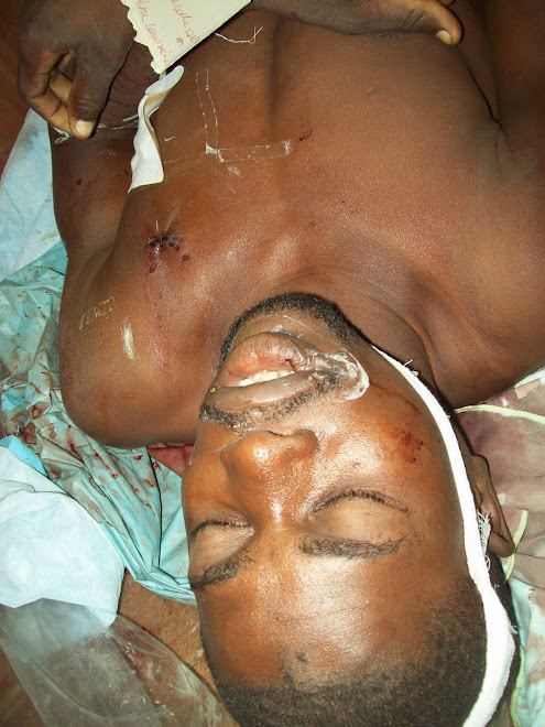 Cap-Haitien : Violence à la Bande du Nord.