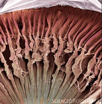 [SPL_ItB_P424157-Ciliary_body,_SEM.jpg]