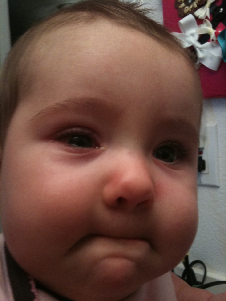 The Payne's Pink Eye