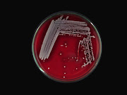 S. aureus in Blood Agar