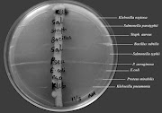 Primary Screening for Antibiosis