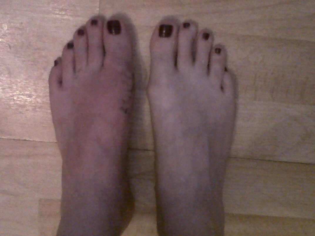 thoughts running through my head.. don't look if you're easily grossed out!!