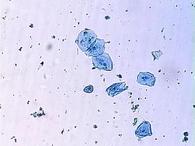 Bio Blogger: Microscope Lab cheek cells microscopic diagram 