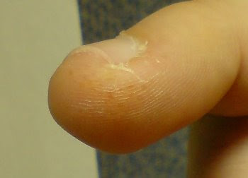 A close up of my right ring finger tip.