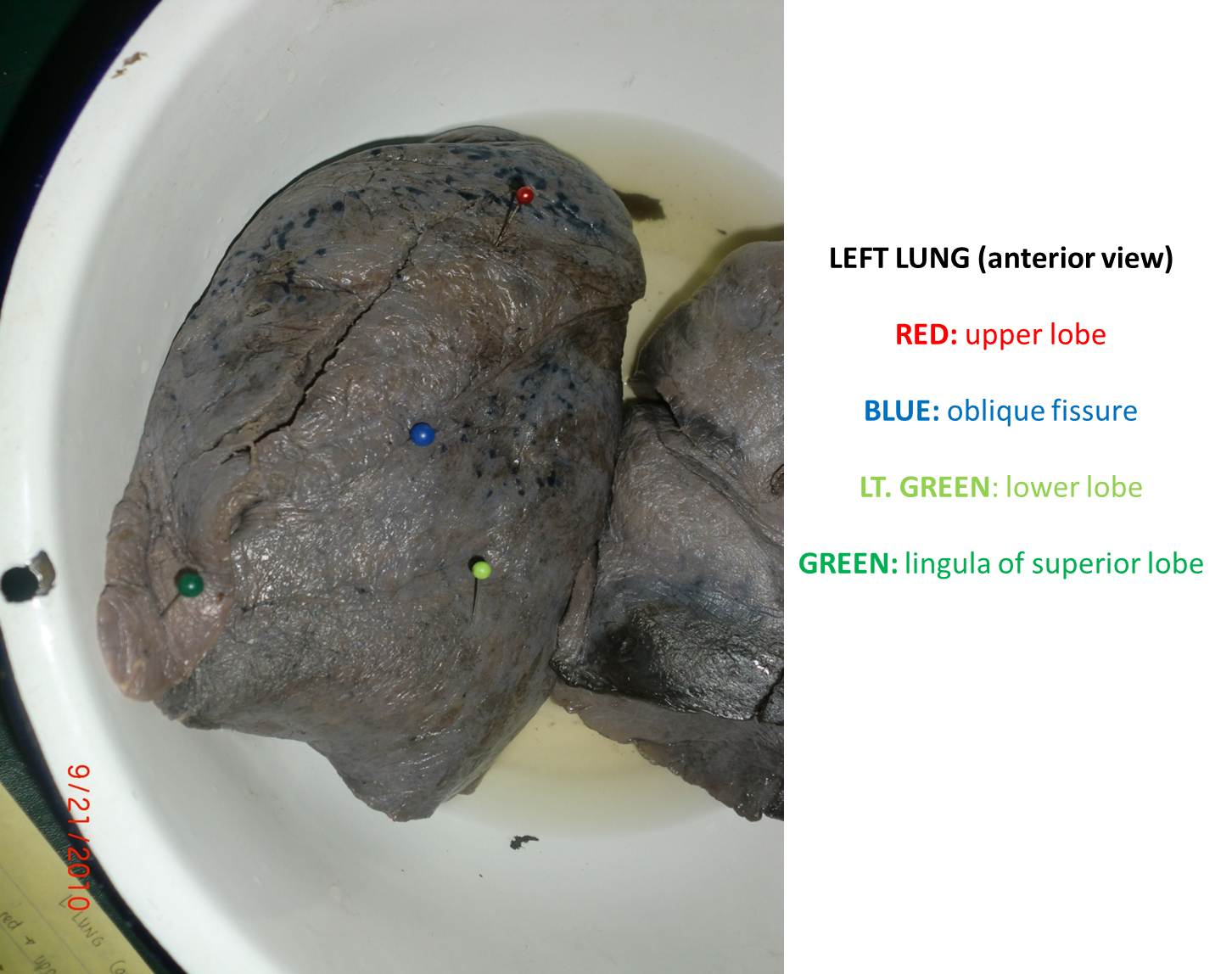 Caduceus: PARTS of the LUNGS