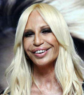 Donatella Versace Awful Plastic Surgery