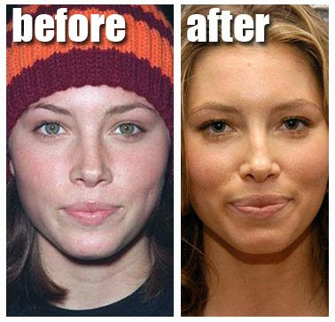 lady gaga before and after nose job. Jessica Biel Nose Job