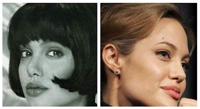 Angelina Jolie Nose Surgery
