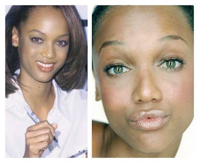 lady gaga before plastic surgery before after. Tyra Banks Before After