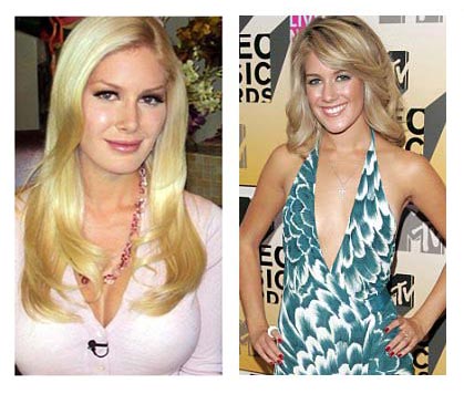 Plastic Surgery Before After: Heidi Montag Plastic Surgery