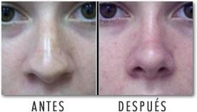 alpiste para adelgazar resultados melates alpiste para adelgazar resultados melates