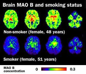 [brainscan-maob-smoker-comparison.jpg]