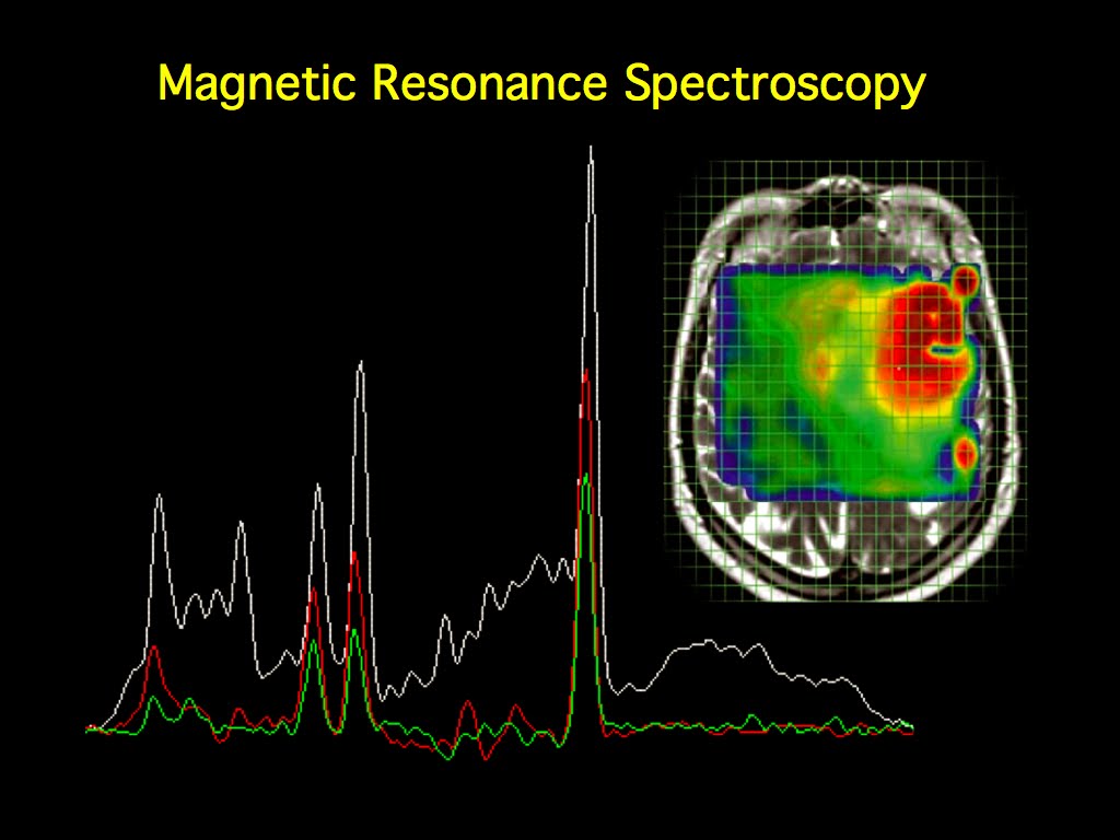 MRI BLOG: Resonance Spectroscopy