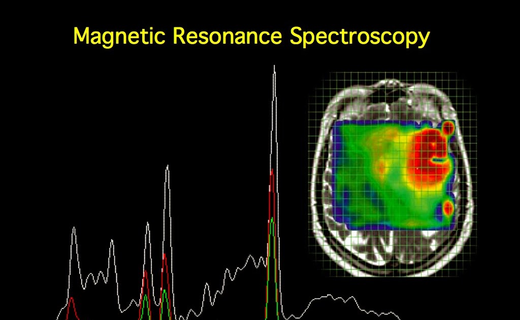 MRI BLOG Resonance Spectroscopy