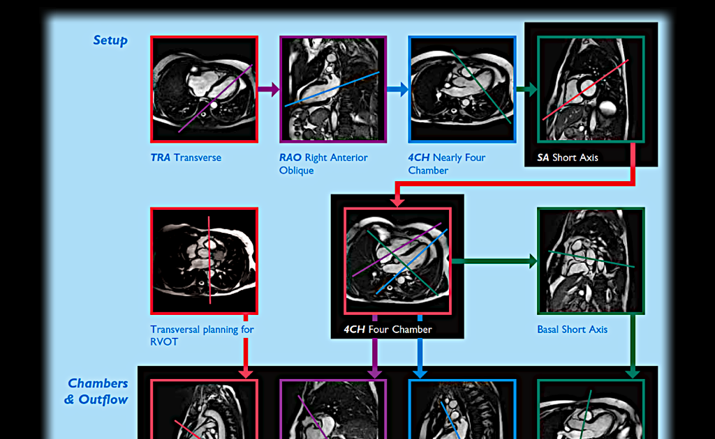 MRI BLOG Cardiac MRI Quick Guide to Imaging planes