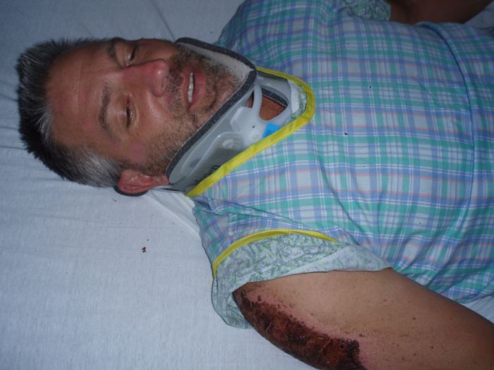 Road Rash