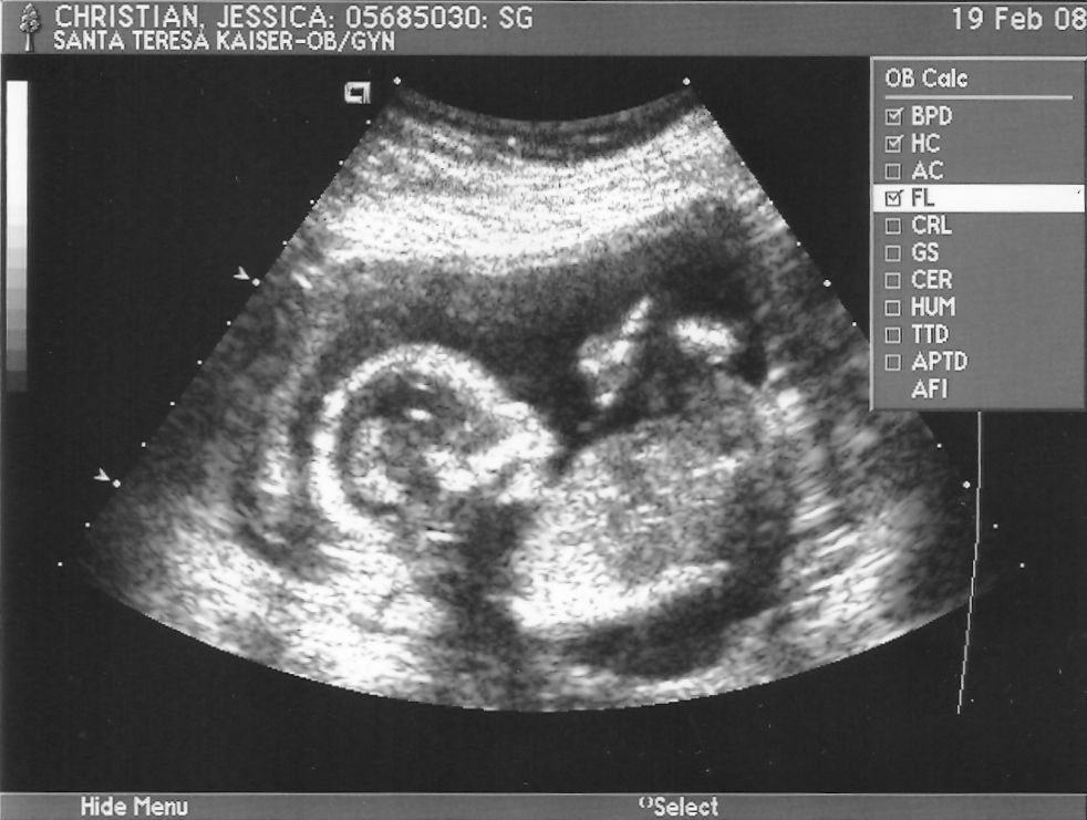 [scan0018.jpg]