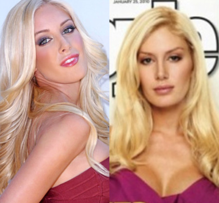 Heidi Montag S Plastic Surgery Before After Photo Letmeget Hot Sex Picture