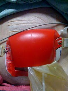 Ostomy-Colostomy-Ileostomy-Designer-Bag