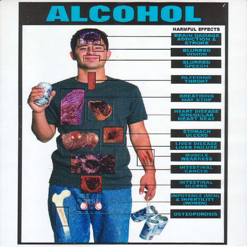 Alcohol Effects Teen 52