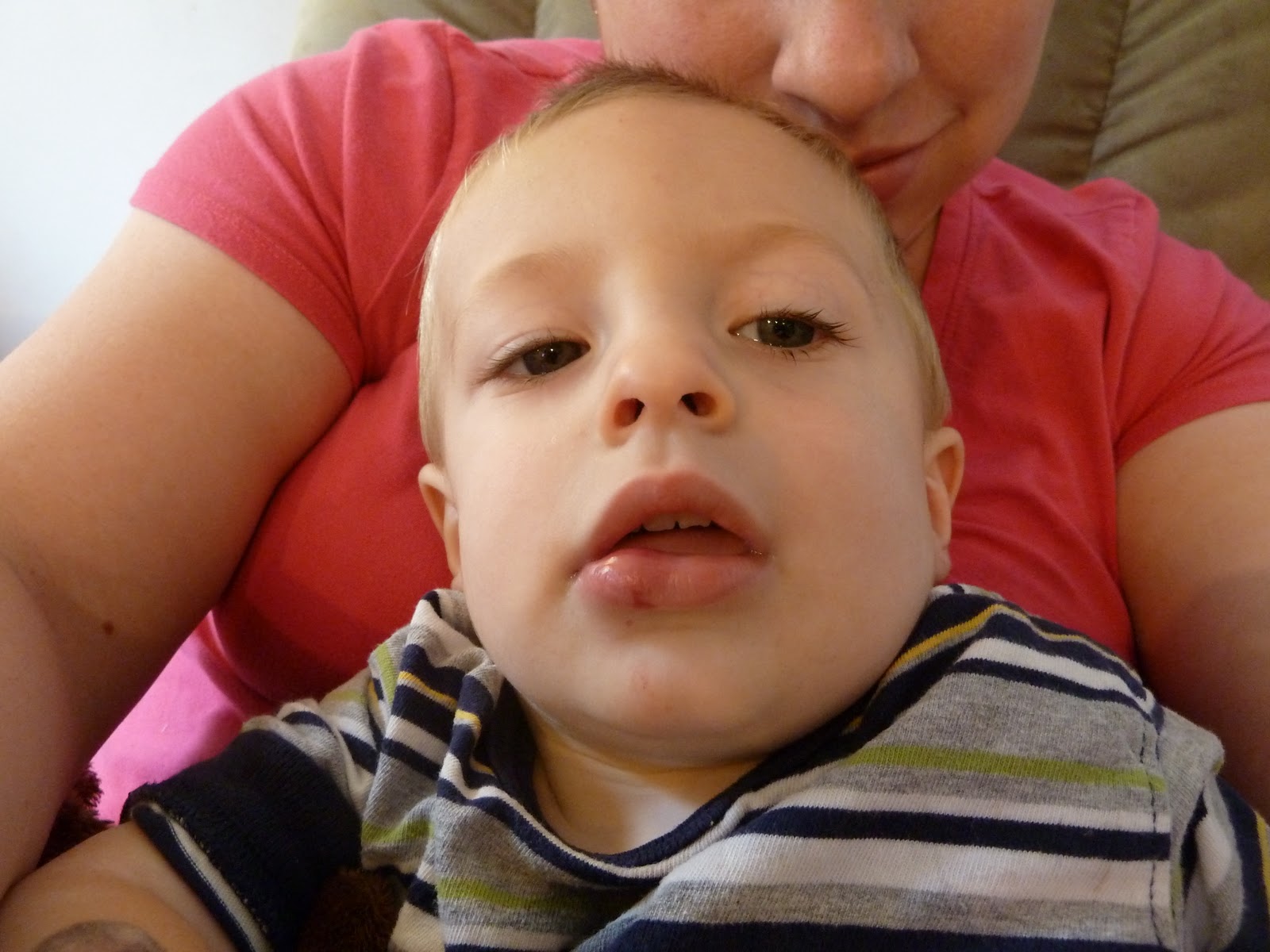 The Vandervort Family Blog Busted Lip. No joke.