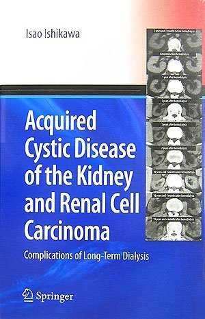 [Acquired+Cystic+Disease+of+the+kyney+and+renal+cell+carcinoma.jpg]