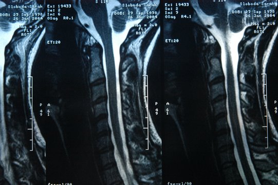[xray1sm.jpg]