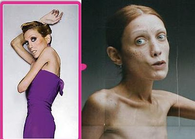 isabelle caro antes y despues anorexicas famosas