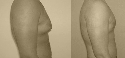 Before and After : See the Difference