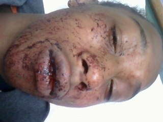 Forum Image: http://3.bp.blogspot.com/_bEOj2c4el8Y/ShMTyVkwlwI/AAAAAAAABZg/gMcL8uG-6nI/s1600/14-year-old-beat-and-choked-by-Police-Trevor-Casey-webcastr.jpeg