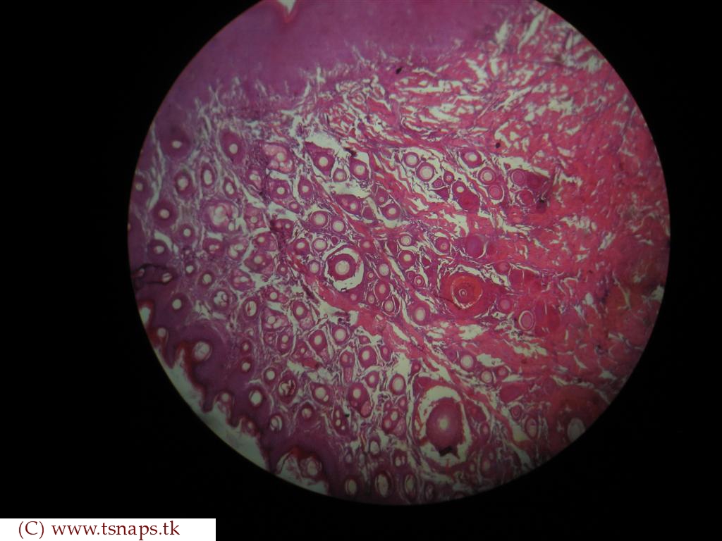 Histology Slides Database human LIP histology slides