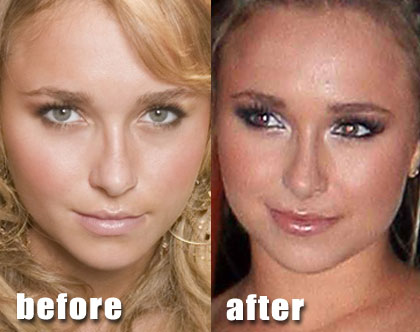 Ashley Tisdale before and after nose job