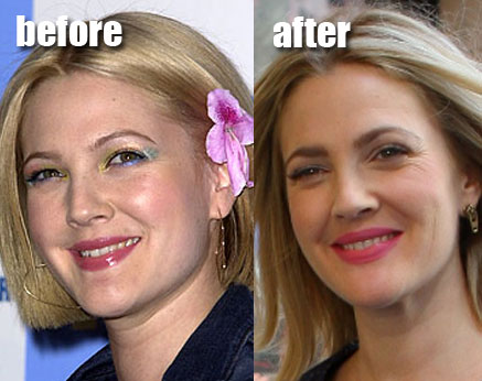 anna faris plastic surgery before after. and after plastic surgery