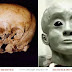 Extraterrestrial DNA Found In 900 Year Old Starchild Skull